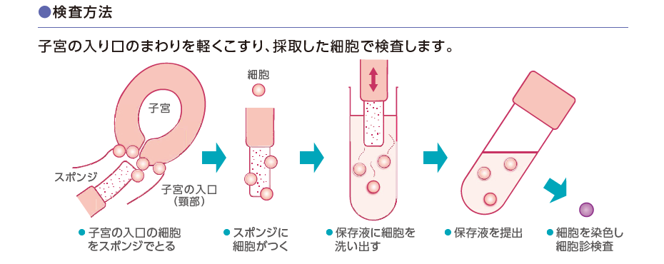 ホームスミアセット®プラス