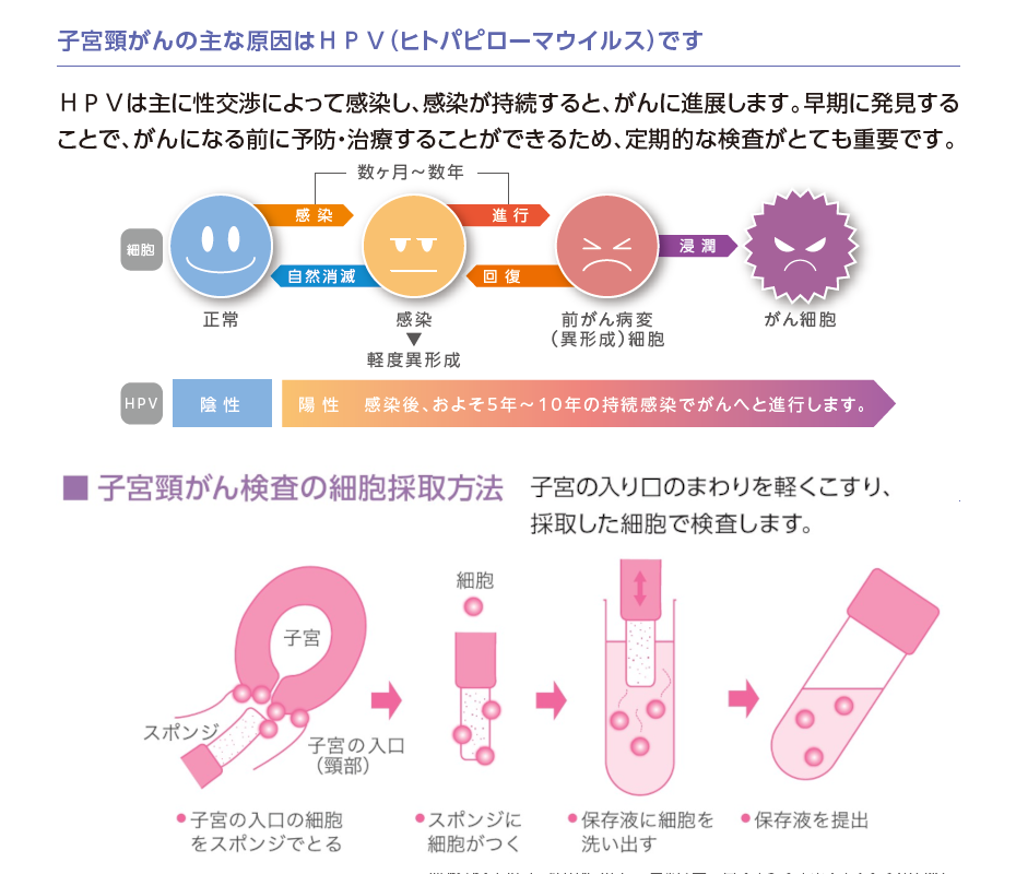 ホームスミアセット®プラス
